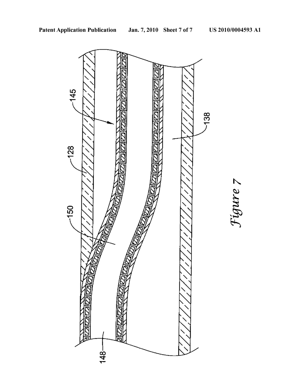 BALLOON CATHETER - diagram, schematic, and image 08