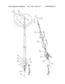 METHOD EMPLOYING A DRAINAGE CATHETER ASSEMBLY FOR DELIVERING A CATHETER TO A BODY diagram and image