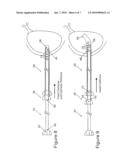 METHOD EMPLOYING A DRAINAGE CATHETER ASSEMBLY FOR DELIVERING A CATHETER TO A BODY diagram and image