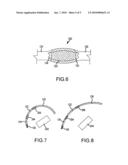 MAGNETIC GUIDED ABLATION CATHETER diagram and image