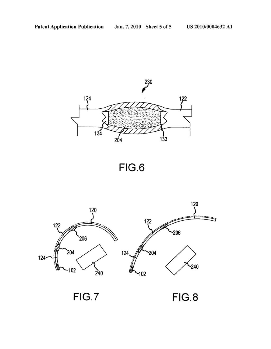 MAGNETIC GUIDED ABLATION CATHETER - diagram, schematic, and image 06