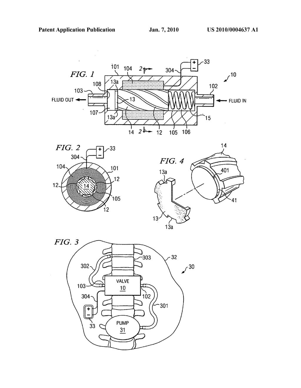 System and method for implantation of devices having unknown biocompatible materials - diagram, schematic, and image 02