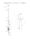  Method for Decreasing the Size and/or Changing the Shape of Pelvic Tissues diagram and image