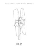 ANCHORING SYSTEM FOR DISC REPAIR diagram and image