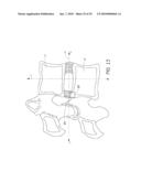 ANCHORING SYSTEM FOR DISC REPAIR diagram and image