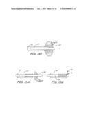 METHODS AND DEVICES FOR THE TREATMENT OF ANEURYSMS diagram and image