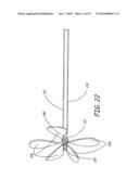 METHODS AND DEVICES FOR THE TREATMENT OF ANEURYSMS diagram and image