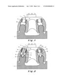 METHOD FOR PRODUCING A BONE PROSTHESIS OR A PRE-IMPLANT SIMULATION, AND EQUIPMENT USED diagram and image