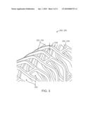 Polymeric Stent diagram and image