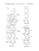 Polymeric Stent diagram and image