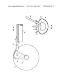 Mechanical apparatus and method for artificial disc replacement diagram and image