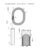 Mechanical apparatus and method for artificial disc replacement diagram and image