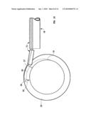 Mechanical apparatus and method for artificial disc replacement diagram and image