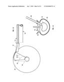 Mechanical apparatus and method for artificial disc replacement diagram and image