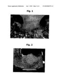 OPEN-PORE BIOCOMPATIBLE SURFACE LAYER FOR AN IMPLANT, METHODS OF PRODUCTION AND USE diagram and image