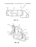 Apparatus and Method for Closing Hospital Bed Gaps diagram and image