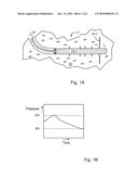 FRACTURING METHOD FOR SUBTERRANEAN RESERVOIRS diagram and image