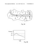 FRACTURING METHOD FOR SUBTERRANEAN RESERVOIRS diagram and image