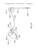 LED work light diagram and image