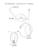 HORSEBACK RIDING SIMULATION diagram and image