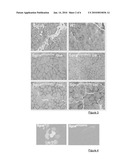 DRUGS FOR THE TREATMENT OF SARCOGLYCANOPATHIES diagram and image