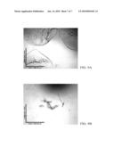 TRIGGERED RELEASE OF DRUGS FROM POLYMER PARTICLES diagram and image