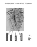 System for Noninvasive Determination of Analytes in Tissue diagram and image