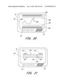 SIGNAL PROCESSING FOR CONTINUOUS ANALYTE SENSOR diagram and image