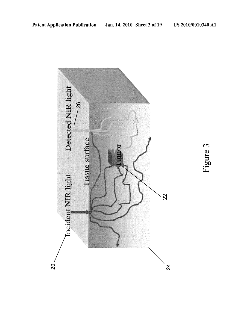 Hand-Held Optical Probe Based Imaging System with 3D Tracking Facilities - diagram, schematic, and image 04