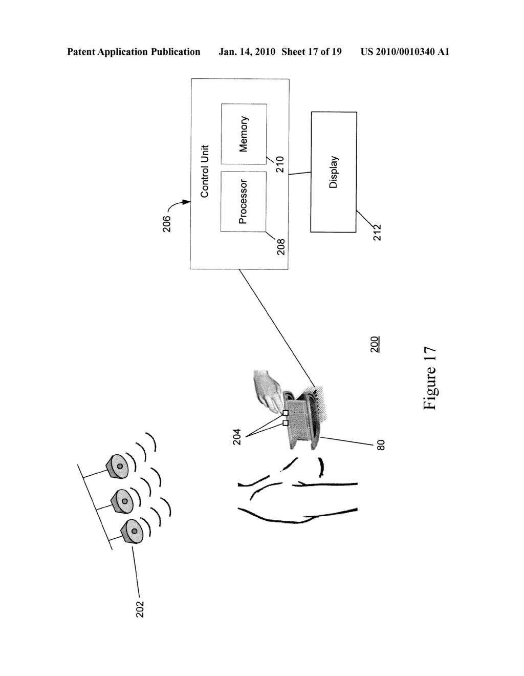 Hand-Held Optical Probe Based Imaging System with 3D Tracking Facilities - diagram, schematic, and image 18