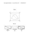 Enhanced Ultrasound Data Processing in an Ultrasound System diagram and image