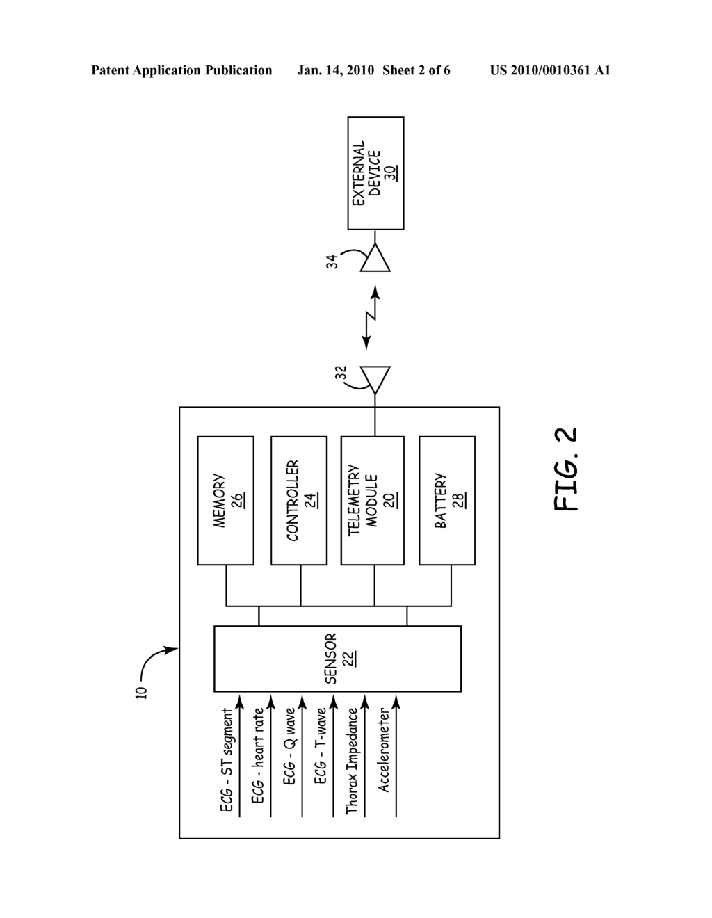 System and Method for Improved Ischemia and Acute Myocardial Infarction Detection - diagram, schematic, and image 03