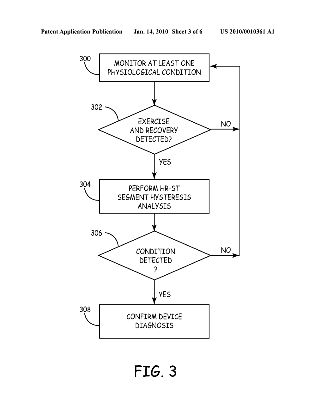 System and Method for Improved Ischemia and Acute Myocardial Infarction Detection - diagram, schematic, and image 04