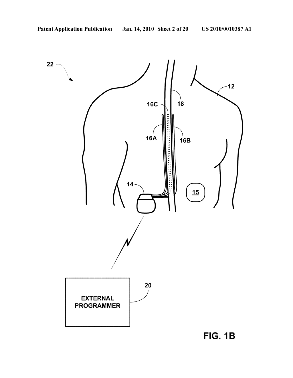 OBTAINING BASELINE PATIENT INFORMATION - diagram, schematic, and image 03