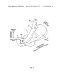 ABSORBENT ARTICLE diagram and image