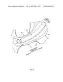 ABSORBENT ARTICLE diagram and image