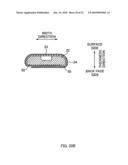 ABSORBENT ARTICLE diagram and image