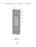 ABSORBENT ARTICLE diagram and image