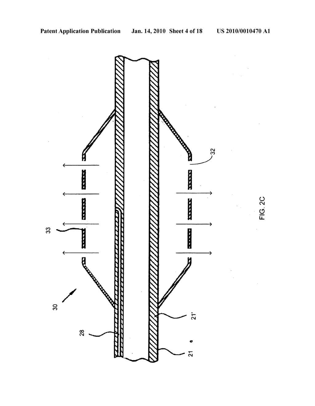 Nanotube-Reinforced Balloons For Delivering Therapeutic Agents Within Or Beyond The Wall of Blood Vessels, And Methods Of Making And Using Same - diagram, schematic, and image 05