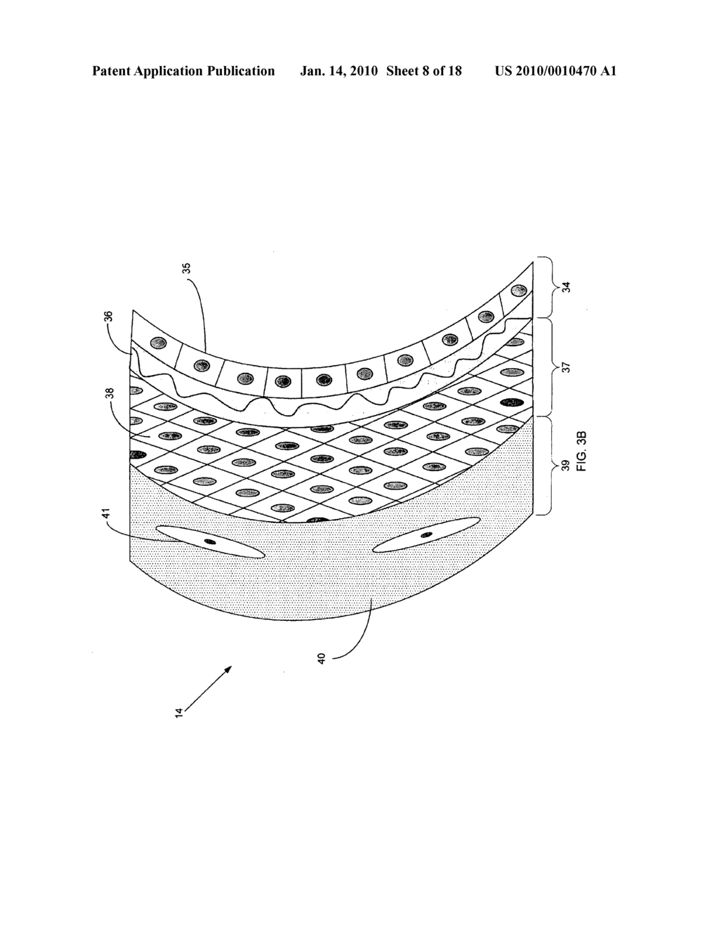 Nanotube-Reinforced Balloons For Delivering Therapeutic Agents Within Or Beyond The Wall of Blood Vessels, And Methods Of Making And Using Same - diagram, schematic, and image 09