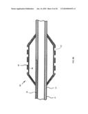 Nanotube-Reinforced Balloons For Delivering Therapeutic Agents Within Or Beyond The Wall of Blood Vessels, And Methods Of Making And Using Same diagram and image