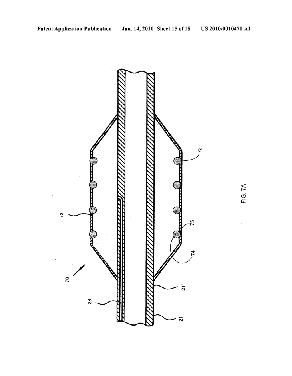 Nanotube-Reinforced Balloons For Delivering Therapeutic Agents Within Or Beyond The Wall of Blood Vessels, And Methods Of Making And Using Same - diagram, schematic, and image 16