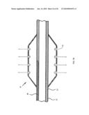 Nanotube-Reinforced Balloons For Delivering Therapeutic Agents Within Or Beyond The Wall of Blood Vessels, And Methods Of Making And Using Same diagram and image