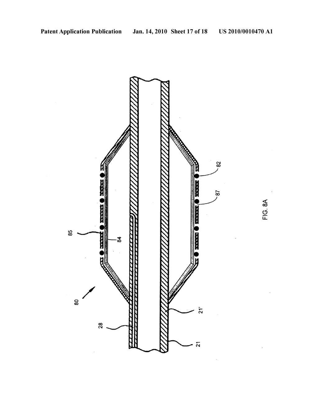 Nanotube-Reinforced Balloons For Delivering Therapeutic Agents Within Or Beyond The Wall of Blood Vessels, And Methods Of Making And Using Same - diagram, schematic, and image 18