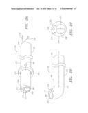 CATHETER WITH TISSUE PROTECTING ASSEMBLY diagram and image