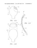 CATHETER WITH TISSUE PROTECTING ASSEMBLY diagram and image