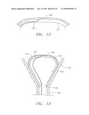 CATHETER WITH TISSUE PROTECTING ASSEMBLY diagram and image