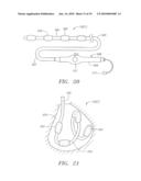 CATHETER WITH TISSUE PROTECTING ASSEMBLY diagram and image