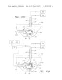 CATHETER WITH TISSUE PROTECTING ASSEMBLY diagram and image