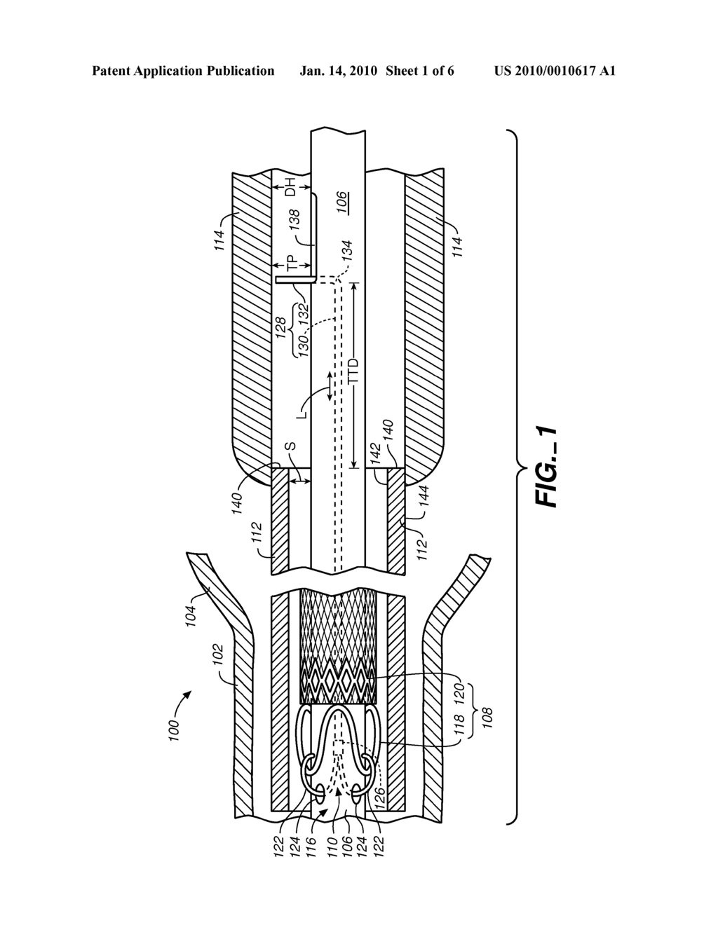 Stent-Graft Delivery System - diagram, schematic, and image 02